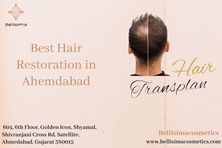 Best Hair Restoration in Ahemdabad.jpeg