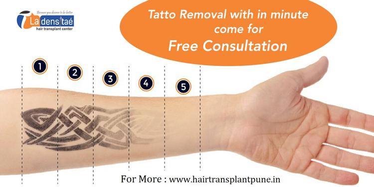 La densitae Tatto Removal Treatment in Pune