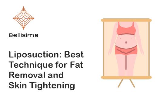 Liposuction Best Technique for Fat Removal and Skin Tightening.png