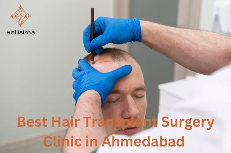 Best Hair Transplant Surgery Clinic in Ahmedabad.jpg