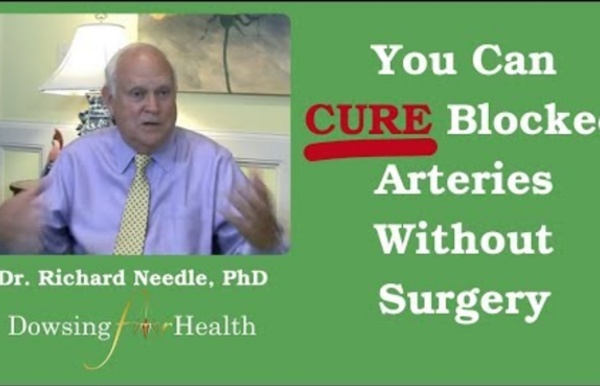 Blocked Arteries Can Be Cured Without Medical Surgery - YouTube