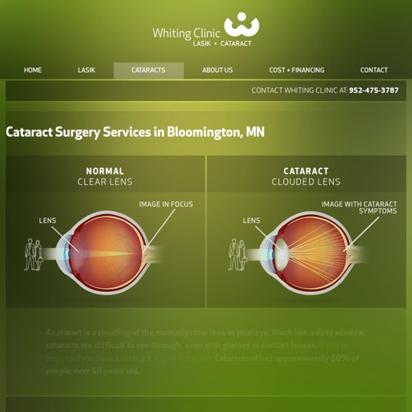 Cataract Surgery Minneapolis