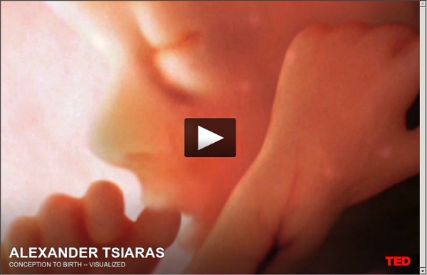 Alexander Tsiaras: Conception to birth