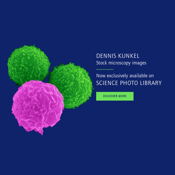 Dennis Kunkel Microscopy - Electron Microscopy Science Stock Photography