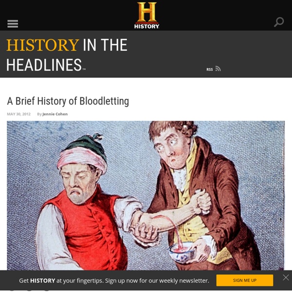 A Brief History of Bloodletting - History in the Headlines