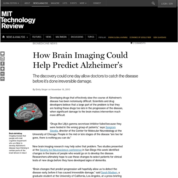 How Brain Imaging Could Help Predict Alzheimer's