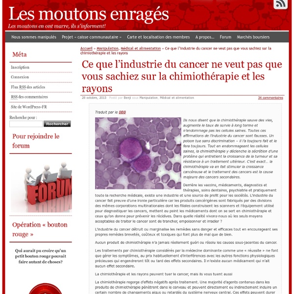 Ce que l’industrie du cancer ne veut pas que vous sachiez sur la chimiothérapie et les rayons