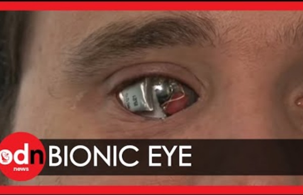 Man sees with 'bionic eye'