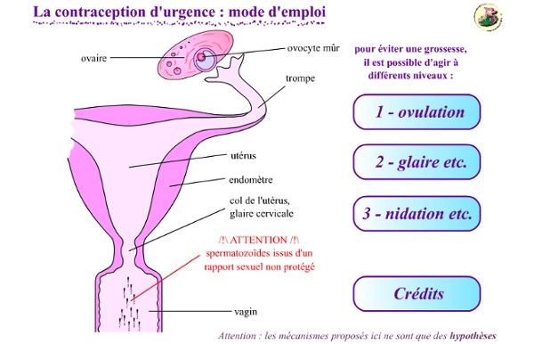 Modes de contraception en animation