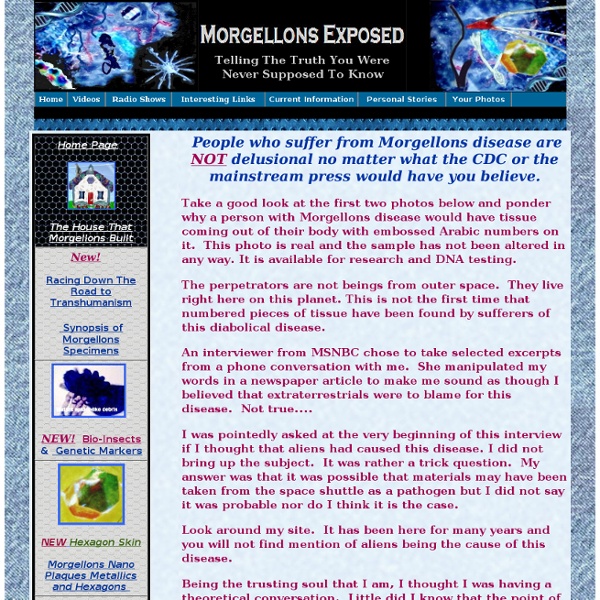Morgellons Exposed - Jan Smith Home Page