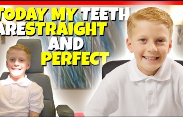 How Jacob Fixed His Crossbite To Get A Super Smile - YouTube