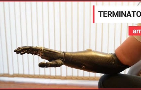 'Terminator' arm is world's most advanced prosthetic limb