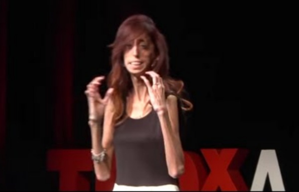 How do you define yourself? Lizzie Velasquez at TEDxAustinWomen