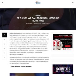 12 Things We Can 3D Print in Medicine