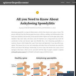 All you Need to Know About Ankylosing Spondylitis – spineorthopediccenter