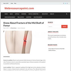 Know About Fracture of the Mid Shaft of Femur