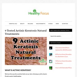 9 Tested Actinic Keratosis Natural Treatments - Healthy Focus