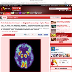 Maladie d'Alzheimer : vers un diagnostic plus simple et plus fiable