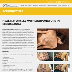Acupuncture in Mississauga