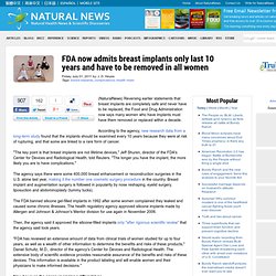 FDA now admits breast implants only last 10 years and have to be removed in all women