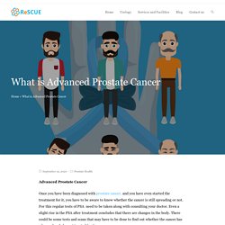 What is Advanced Prostate Cancer - ReSCUE Urology Hospital Blog