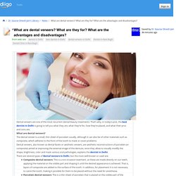 What are dental veneers? What are they for? What are the advantages and disadvantages?