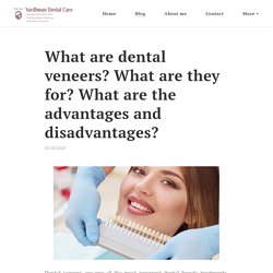 What are dental veneers? What are they for? What are the advantages and disadvantages?