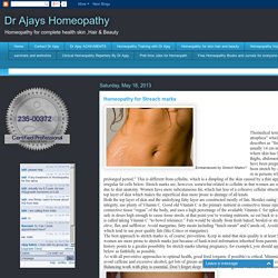 Dr Ajays Homeopathy : Homeopathy for Streach marks