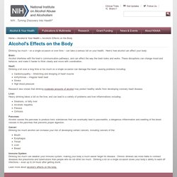National Institute on Alcohol Abuse and Alcoholism (NIAAA)