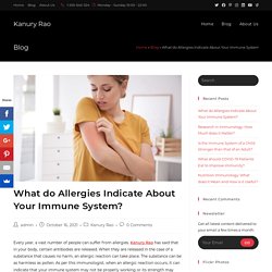 What do Allergies Indicate About Your Immune System? - Kanury Rao