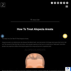How To Treat Alopecia Areata — Ziering Medical