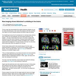 New imaging shows Alzheimer's unfolding in live brains - health - 18 September 2013
