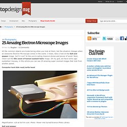 25 Amazing Electron Microscope Images