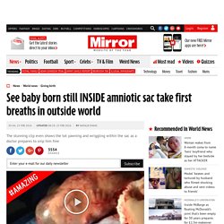See baby born still INSIDE amniotic sac take first breaths in outside world