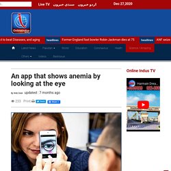 An app that shows anemia by looking at the eye