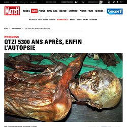 Otzi, l'homme des glaces, 5300 ans après, enfin l’autopsie