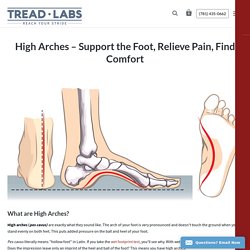 High Arches – Support the Foot, Relieve Pain, Find Comfort