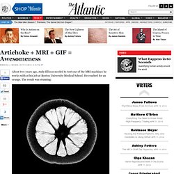 Artichoke + MRI + GIF = Awesomeness