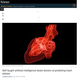 Self-taught artificial intelligence beats doctors at predicting heart attacks