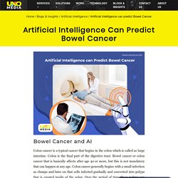 Artificial Intelligence can predict Bowel Cancer