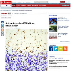 Autism Associated With Brain Inflammation