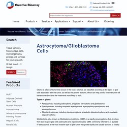 Astrocytoma/Glioblastoma cells