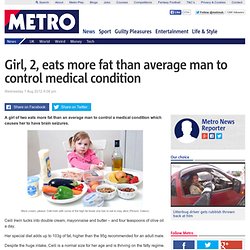 2-yaer-old Ceili Irwin eats more fat than average man to control medical condition