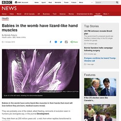 Babies in the womb have lizard-like hand muscles
