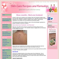 Home remedies that can be used as back acne treatment