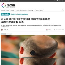 Signs of balding, advice: Can high testosterone cause hair loss?