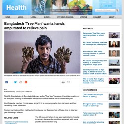 Bangladesh 'Tree Man' wants hands amputated to relieve pain