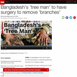 Bangladesh's 'tree man' to have surgery