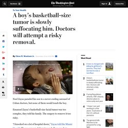 A boy’s basketball-size tumor is slowly suffocating him. Doctors will attempt a risky removal.