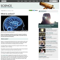 BBC Science - What is autism?